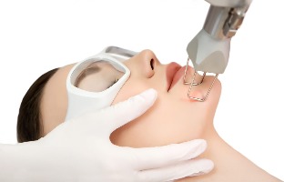 Laser rejuvenation of face skin